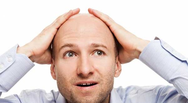 Queda de Cabelo Masculina