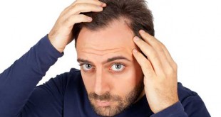 Como prevenir a queda de cabelo?