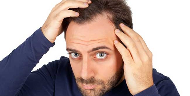 Como prevenir a queda de cabelo?