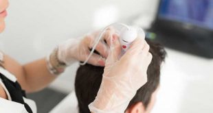 Transplante de Cabelo